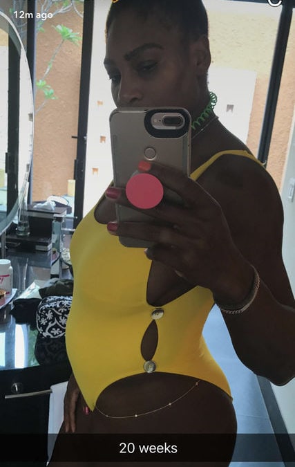 A Pregnant Serena Williams Wins the Australian Open. What’s She Teaching Us About Exercise and Pregnancy?