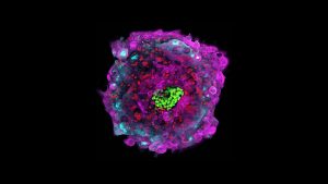 If You Could Reduce Miscarriages by Letting Scientists Study Human Embryos Longer, Would You?