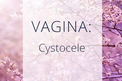 About Cystocele | Los Angeles Gynecologist Thais Aliabadi located near Beverly Hills at Cedars-Sinai Hospital