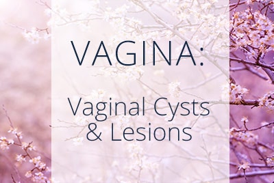 Benign Vaginal Cysts and Lesions