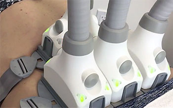 Advantages of SculpSure, Menopause Center Los Angeles Advantages of SculpSure, Menopause Center Los Angeles