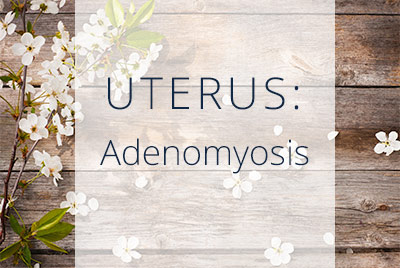 Adenomyosis causes and Treatments from Los Angeles Gynecologist and Gynecological Surgeon Thais Aliabadi located near Bevery Hills at Cedars-Sinai