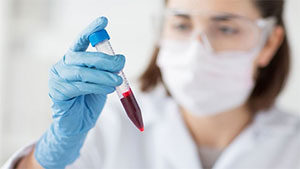 Blood test for diagnosing endosmetriosis