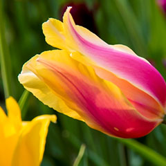 Interstitial Cystitis (Painful Bladder Syndrome) Interstitial Cystitis (Painful Bladder Syndrome)