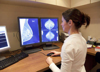 3d-Mammogram-main Why 3D mammograms and diagnosing breast cancer