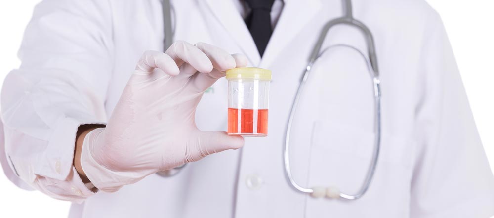 Antibiotic Resistant UTIs