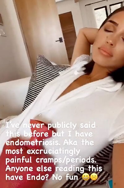 Model Olivia Culpo, Dr. Aliabadi patient, reveals she has endometriosis