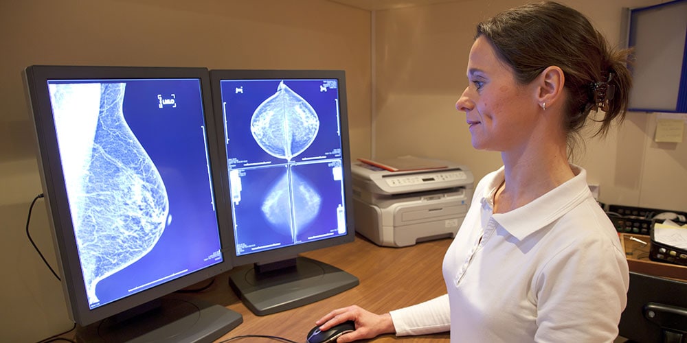 Doctor looking at mammogram