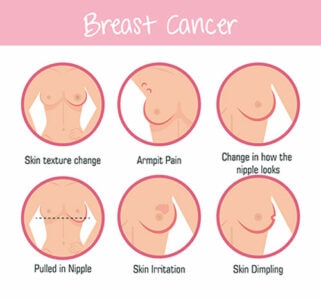 Illustration of breast cancer symtpoms. Text reads: Breast Cancer. Skin texture change. Armpit pain. Change in how the nipple looks. Pulled in Nipple. Skin irritation. Skin dimpling.