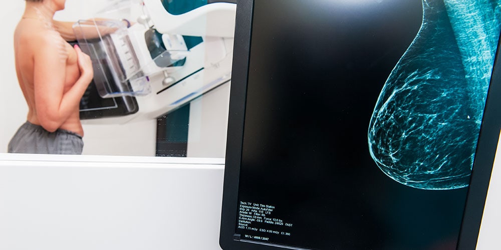 Close up of a mammogram scan with woman receiving mammogram in background