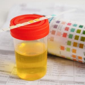 How is interstitial cystitis diagnosed? 
