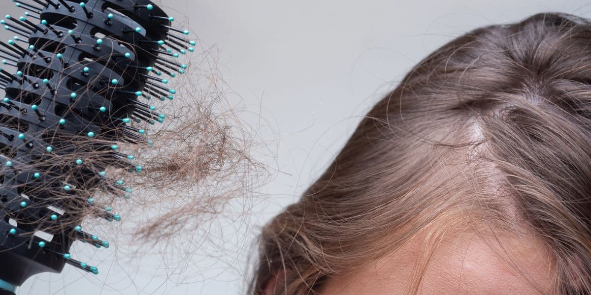 Women’s Hormonal Hair Loss 