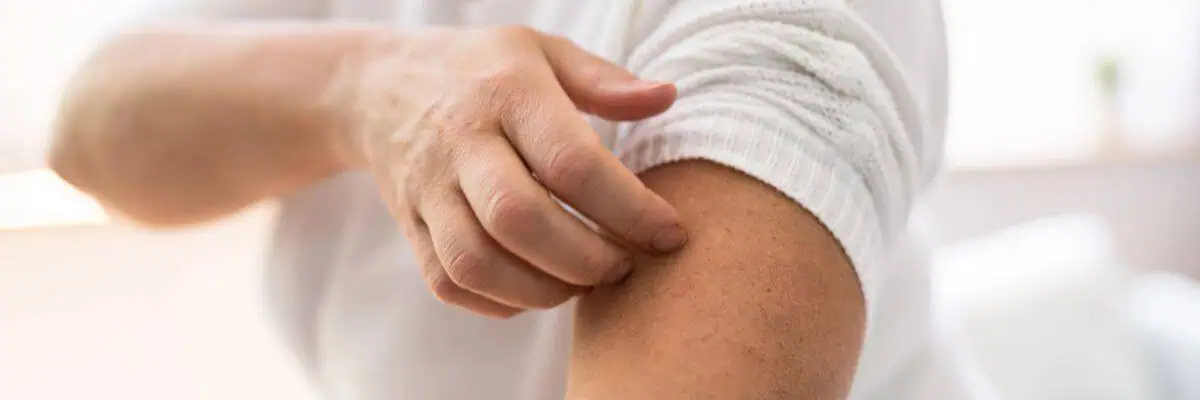 Dry and Itchy Skin in Menopause