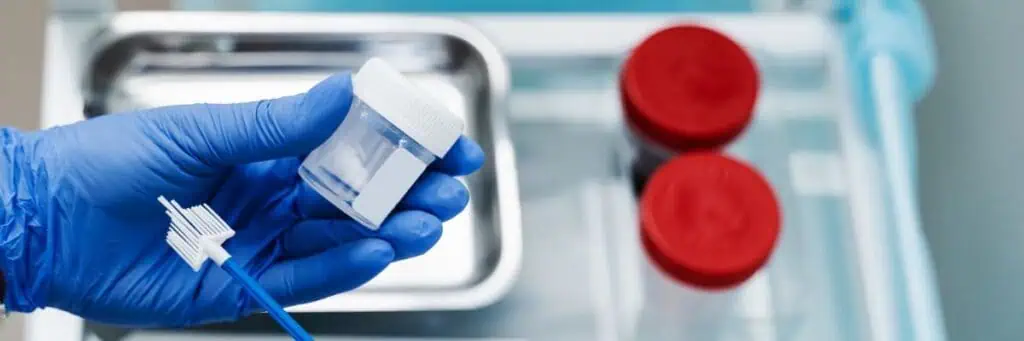 Pap Smear test kit
