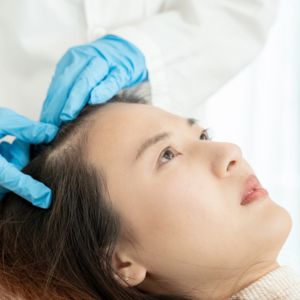 What are medical treatments for female hair loss