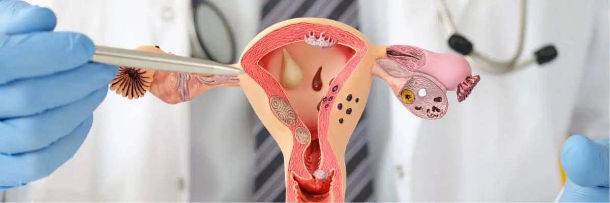 What is salpingitis?