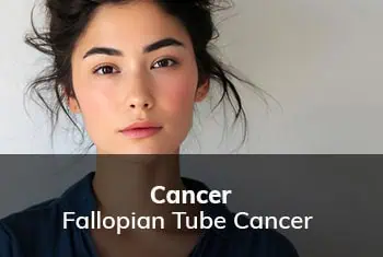 Fallopian Tube Cancer
