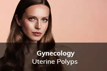 Uterine Polyps, Dr. Thais Aliabadi | Top Gynecological Surgeon