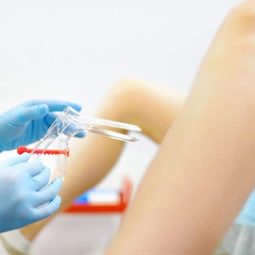 Pap Smear Screening 500x500