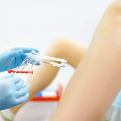 Pap Smear Screening 500x500