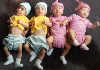 Twins, Quads, Multiple Pregnacies FAQ